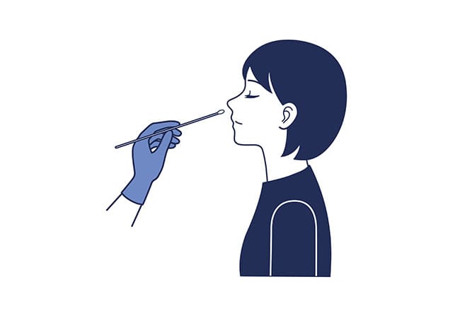 検査